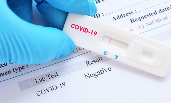 Cрок действия ПЦР-теста на COVID-19